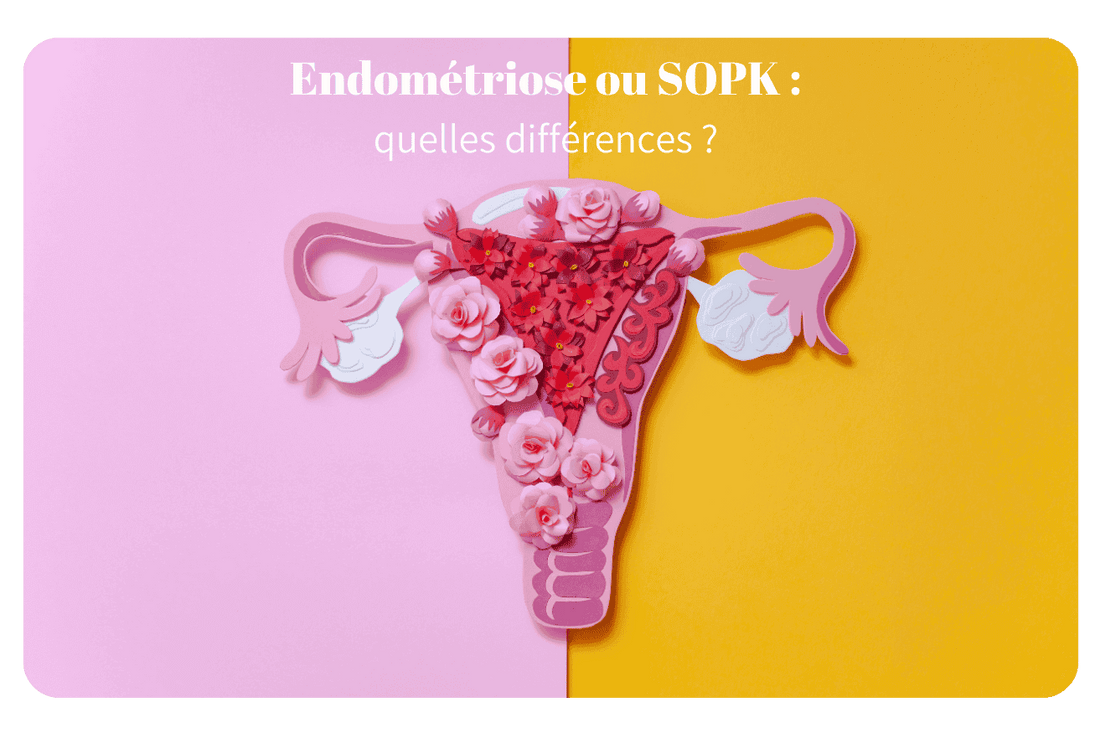 L'endométriose et SOPK